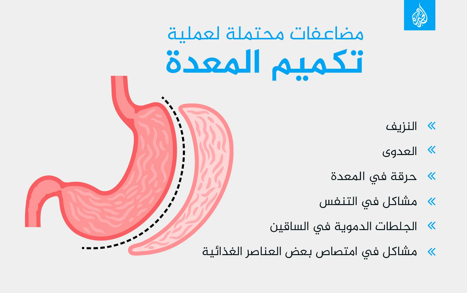 تكميم المعدة: هل هو الحل الأمثل لإنقاص الوزن وتحسين الصحة؟