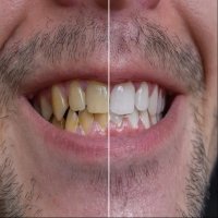 5 تغييرات في الفم توحي بحالات صحية خطيرة